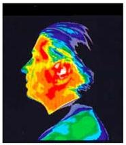 Thermographic Image after 15 mins